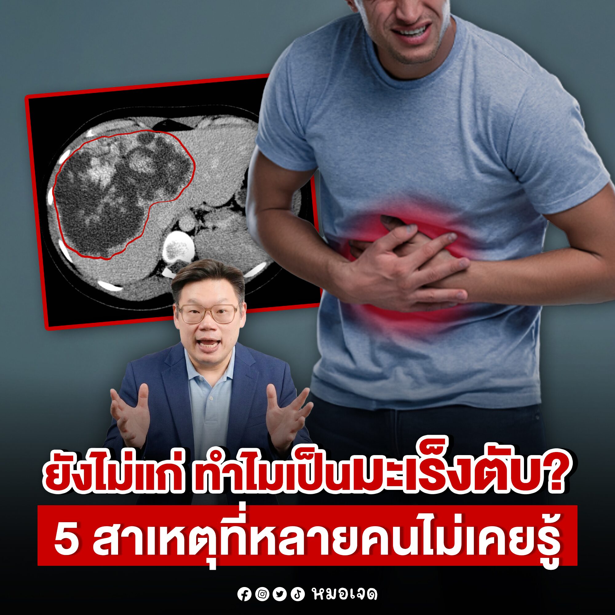 มะเร็งตับ