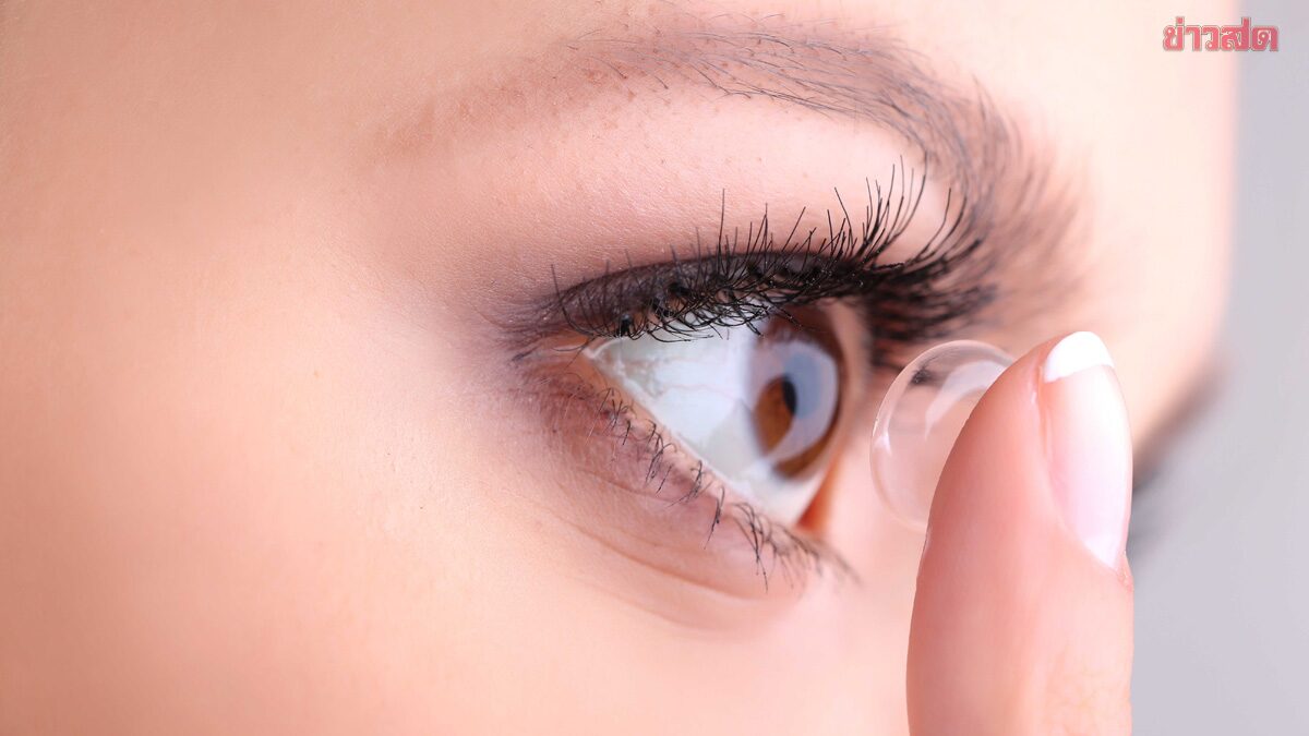 Woman Wore Colored Contact Lenses Daily for 20 Years Thinking It Was Just Dry Eyes—Doctor Warns Her Corneas Were Oxygen-Deprived Without Her Knowledge