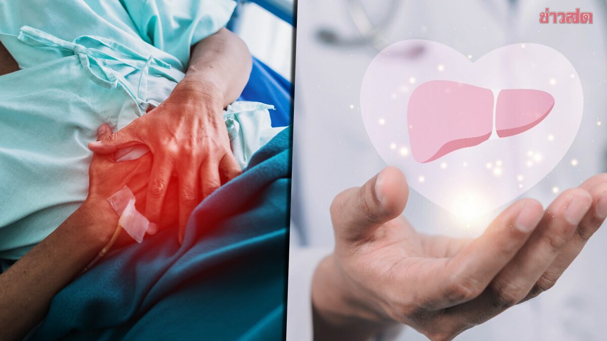 ยังหาที่มาไม่พบ! กรมควบคุมโรค โต้ข่าว ‘โรงงานชลบุรี’ สาเหตุแพร่ ตับอักเสบเอ