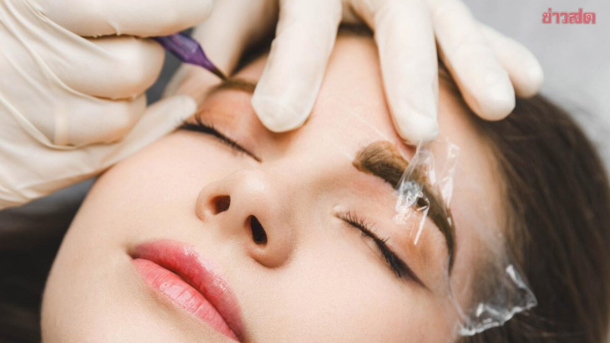 เตือนภัยความงาม! หญิงวัย 46 ปี สักคิ้วมา 15 เดือน เกิดผื่นสีม่วงลุกลามทั่วร่างกาย