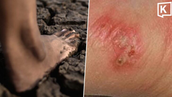 Thai govt warns on melioidosis as cases reach 732