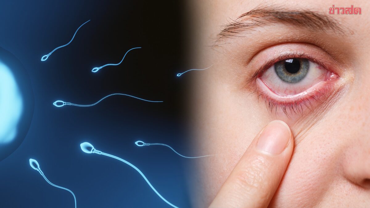 แพทย์เฉลยเอง! จะเกิดอะไรขึ้น ถ้า “อสุจิ” เข้าตา แนะวิธีรับมือ ทำผิดเสี่ยงตาอักเสบ