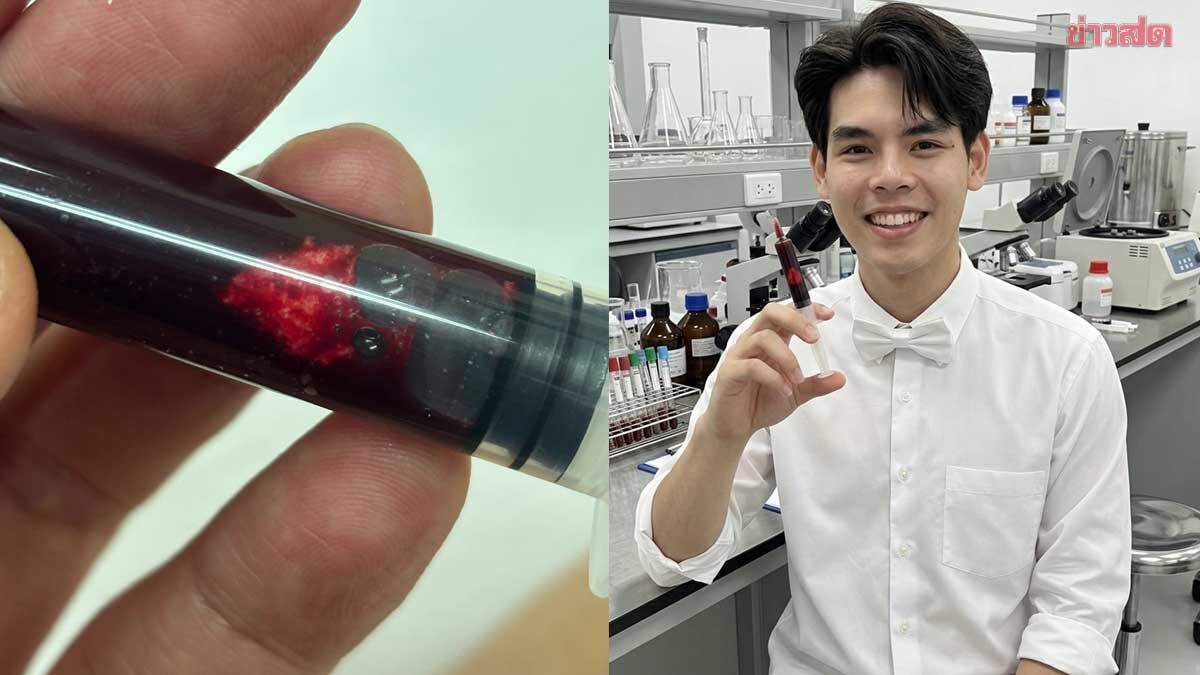 หมอเผยห้ามเชื่อ ให้งดน้ำก่อนเจาะเลือด ไม่ถูกหลัก เปิดผลกระทบที่ตามมา