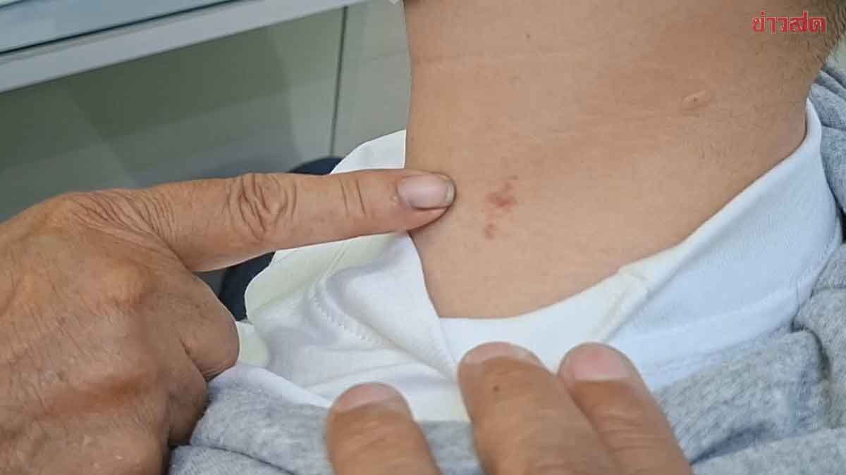 มอบตัวแล้ว2 แก๊งกระเทย รุมอนาจาร ดูดคอหนุ่มหน้าตาดี เหลืออีก1 ตร.จ่อหมายเรียก