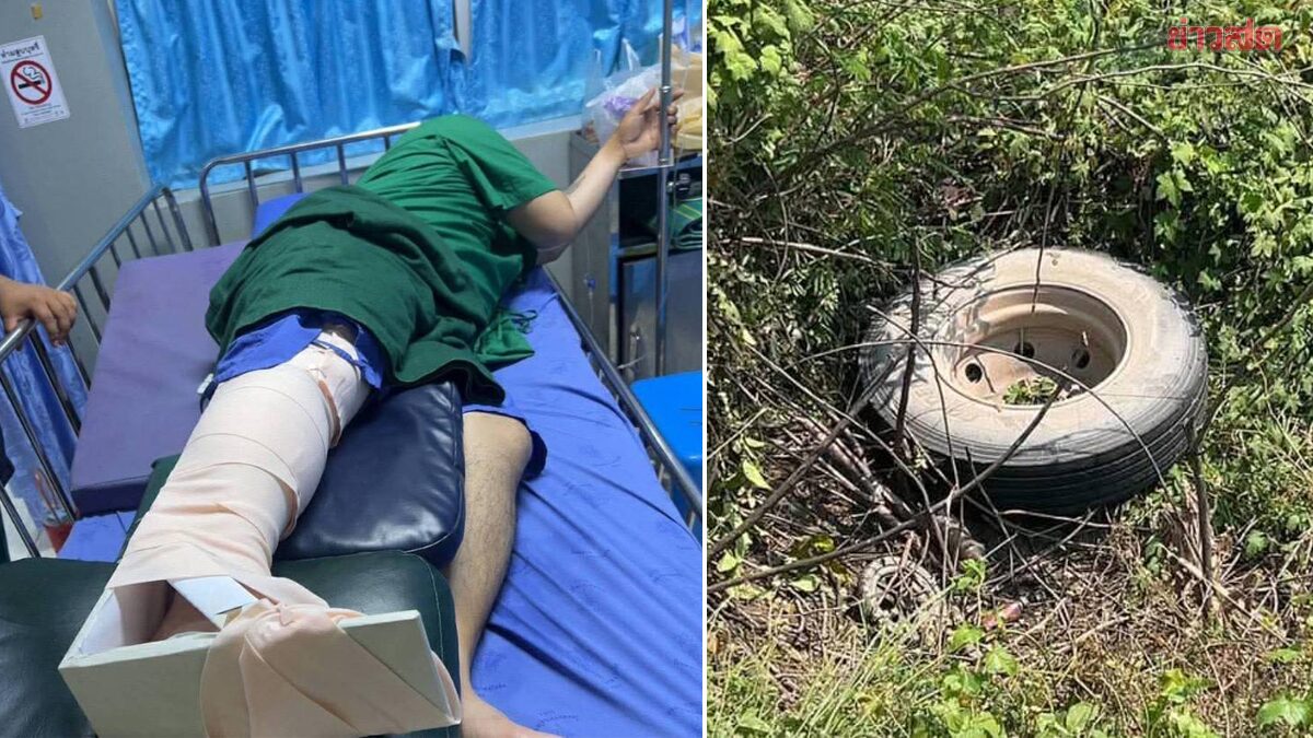 หนุ่มส่งของยืนริมถนน รถพ่วงขับผ่าน จู่ๆ ล้อหลุดกระเด็นใส่เจ็บสาหัส 1 เดือนยังไร้เยียวยา