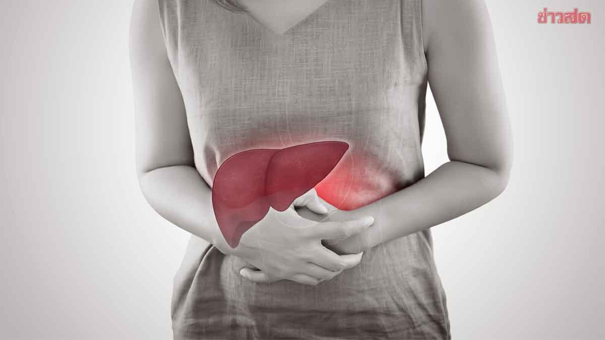 รีบเช็กก่อนสาย! หมอเจด เผยถ้ามีอาการแบบนี้ อย่าปล่อยผ่าน เสี่ยงมะเร็งตับ-ท่อน้ำดี