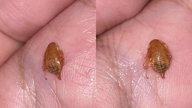 นี่ตัวอะไร แฟนระคายคอมา 3 วัน ไอแล้วหลุดออกมา พอรู้คำตอบ อยากร้องไห้แทน