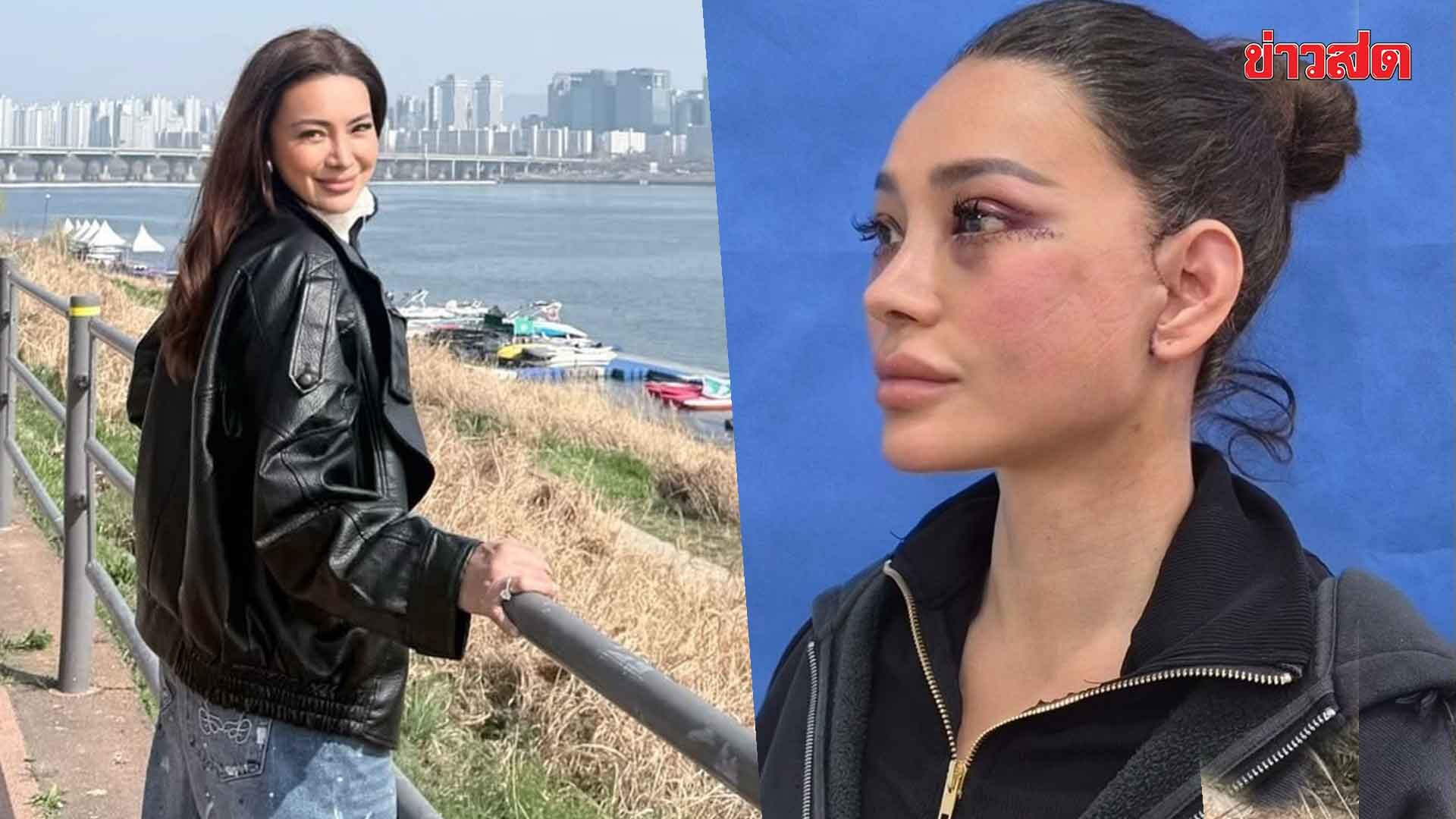 47 แล้วงัยใครแคร์! โย-ยศวดี บินเกาหลียกหน้าใหม่ Full Face Lift  3 วันผ่าน สวยกระชากวัย