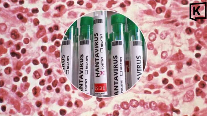 Govt says no hantavirus outbreak, increases screening