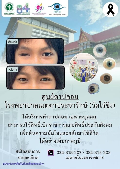 'ลูกตาปลอม'