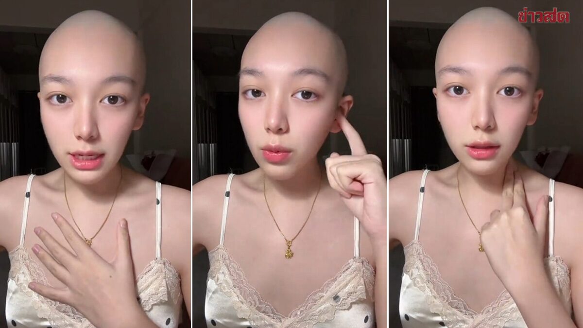 สาวช็อก เจอป่วย มะเร็งต่อมน้ำเหลือง ในวัย 21 ปี เผยอาการเริ่