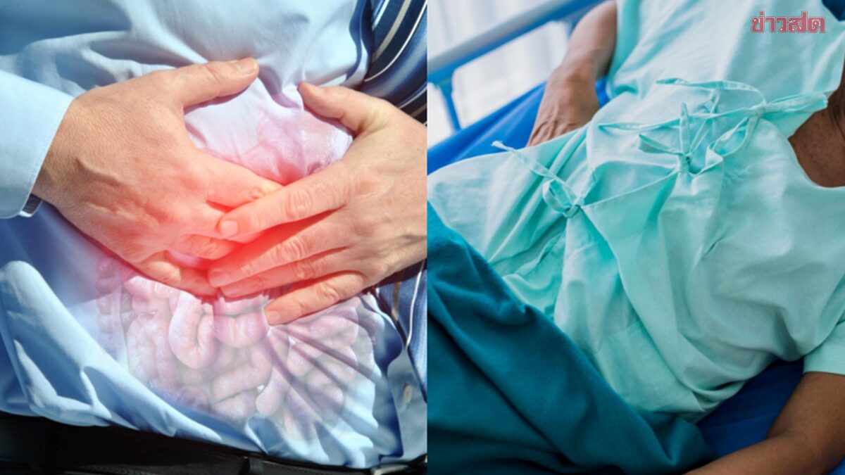 Executive's 8kg Weight Loss Masks Rectal Cancer Diagnosis