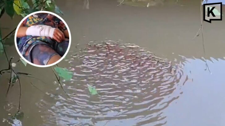 Boy Bitten by Giant Snakehead While Playing With Fry